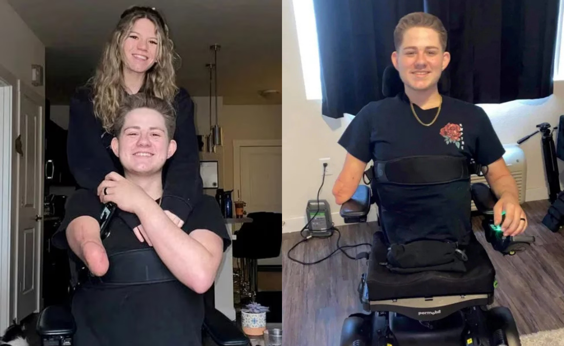 Loren Schauers: His Accident, Hemicorporectomy, Recovery, Wife and Life Today